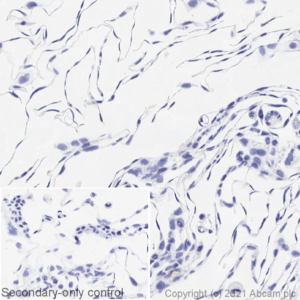 Immunohistochemistry (Formalin/PFA-fixed paraffin-embedded sections) - Anti-BRAF (mutated V600E) antibody [VE1] - BSA and Azide free (AB324341)