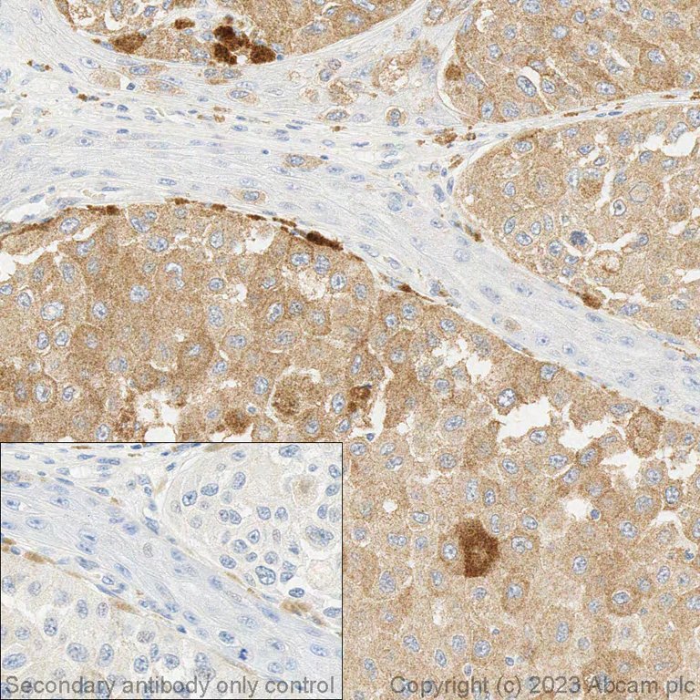 Immunohistochemistry (Formalin/PFA-fixed paraffin-embedded sections) - Anti-BRAF (mutated V600E) antibody [VE1] - BSA and Azide free (AB324341)