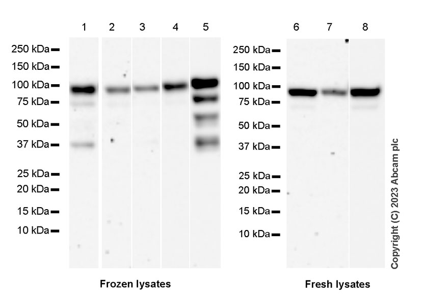 Western blot - Anti-BRAF (phospho S446) antibody [EPR28069-63] (AB313793)