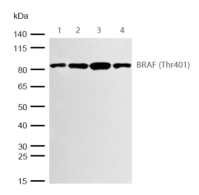 Western blot - Anti-BRAF (phospho T401) antibody [JJ08-72] (AB326635)
