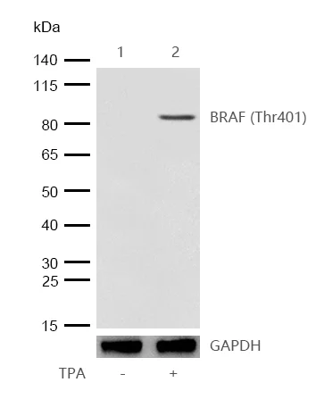 Western blot - Anti-BRAF (phospho T401) antibody [JJ08-72] (AB326635)