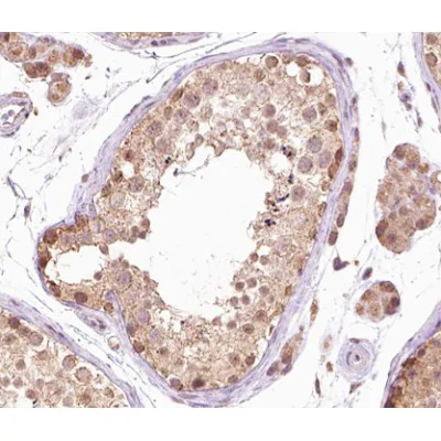Immunohistochemistry (Formalin/PFA-fixed paraffin-embedded sections) - Anti-BRAF (phospho T599) antibody (AB192813)