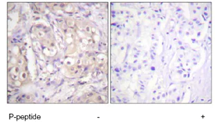 Immunohistochemistry (Formalin/PFA-fixed paraffin-embedded sections) - Anti-BRAF (phospho T599) antibody (AB59406)