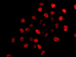 Immunocytochemistry/ Immunofluorescence - Anti-BRAF35 antibody [EPR9915] (AB167415), expandable thumbnail