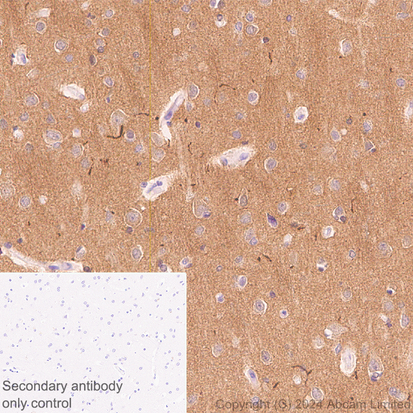 Anti-Brain-derived Tau antibody [EPR29150-21] (ab322059) | Abcam
