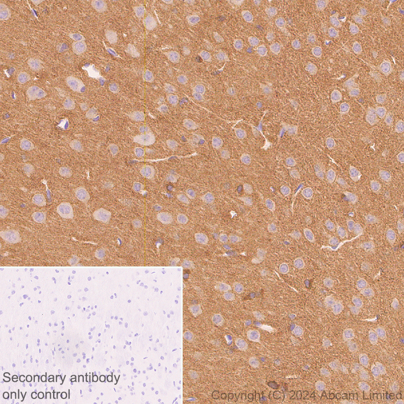 ■TOMU0402ページ■ brain-derived-tau-antibody-