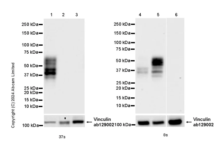 Western blot - Anti-Brain-derived Tau antibody [EPR29150-21] (AB322059)