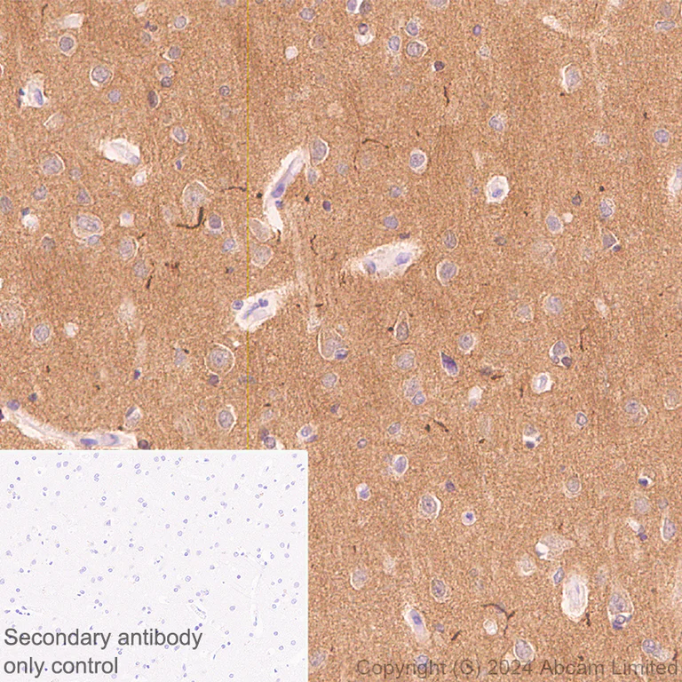 Immunohistochemistry (Formalin/PFA-fixed paraffin-embedded sections) - Anti-Brain-derived Tau antibody [EPR29150-21] - BSA and Azide free (AB322060)