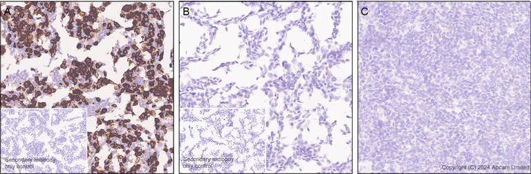 Immunohistochemistry (Formalin/PFA-fixed paraffin-embedded sections) - Anti-Brain-derived Tau antibody [EPR29150-21] - BSA and Azide free (AB322060)