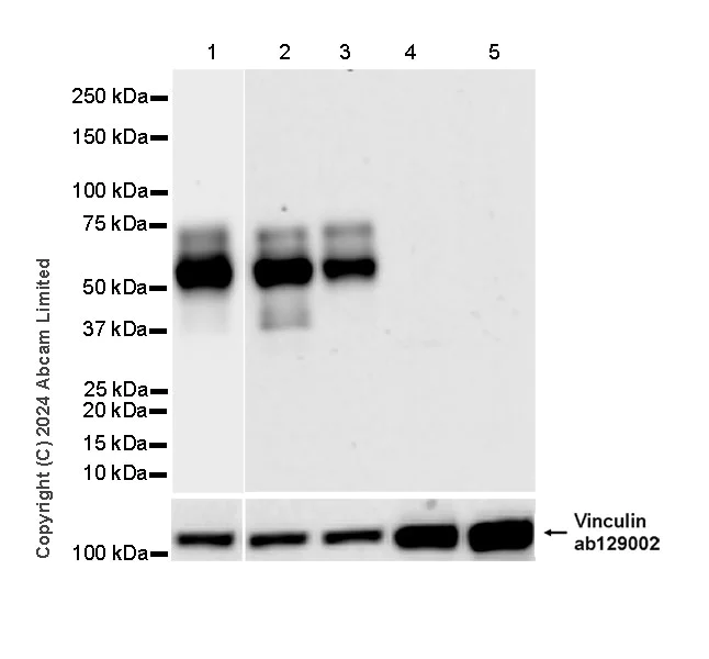 Western blot - Anti-Brain-derived Tau antibody [EPR29150-21] - BSA and Azide free (AB322060)