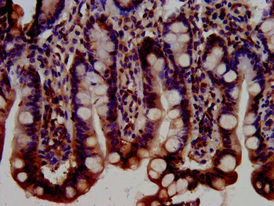 Immunohistochemistry (Formalin/PFA-fixed paraffin-embedded sections) - Anti-BRAP antibody (AB237505)