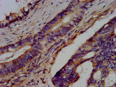 Immunohistochemistry (Formalin/PFA-fixed paraffin-embedded sections) - Anti-BRAP antibody (AB237505)