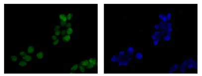 Immunocytochemistry/ Immunofluorescence - Anti-BRAT1 antibody [EPR13753] - BSA and Azide free (AB250526)
