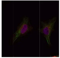 Immunocytochemistry/ Immunofluorescence - Anti-BRCA1 antibody (AB131360)