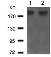 Western blot - Anti-BRCA1 antibody (AB131360), expandable thumbnail