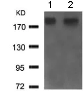 Western blot - Anti-BRCA1 antibody (AB131360)