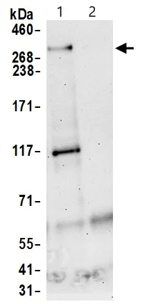 Immunoprecipitation - Anti-BRCA1 antibody (AB9141)