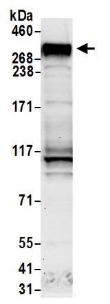 Western blot - Anti-BRCA1 antibody (AB9141)