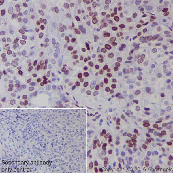 Immunohistochemistry (Formalin/PFA-fixed paraffin-embedded sections) - Anti-BRCA1 antibody [EPR19433] (AB213929)