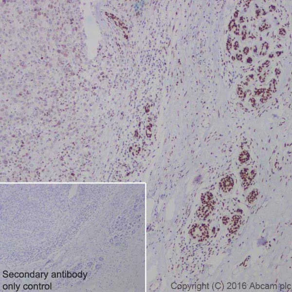Immunohistochemistry (Formalin/PFA-fixed paraffin-embedded sections) - Anti-BRCA1 antibody [EPR19433] (AB213929)