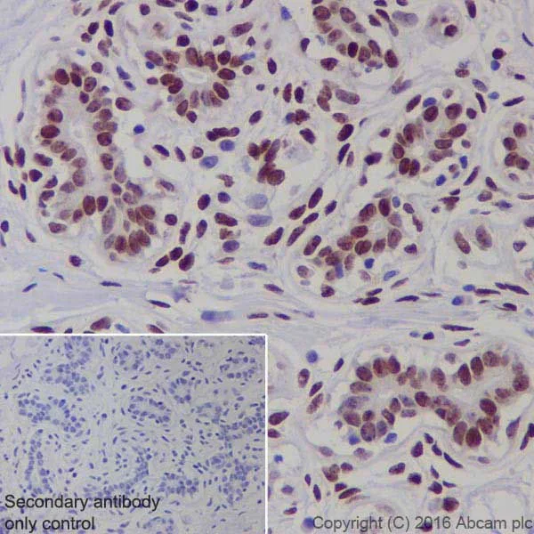 Immunohistochemistry (Formalin/PFA-fixed paraffin-embedded sections) - Anti-BRCA1 antibody [EPR19433] - BSA and Azide free (AB215988)