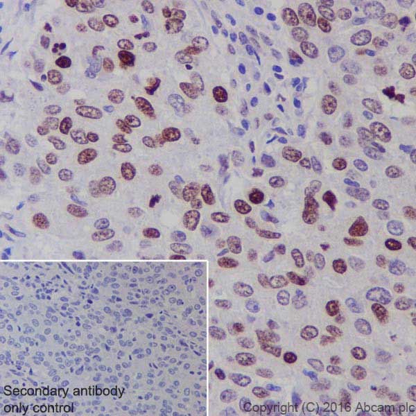 Immunohistochemistry (Formalin/PFA-fixed paraffin-embedded sections) - Anti-BRCA1 antibody [EPR19433] - BSA and Azide free (AB215988)