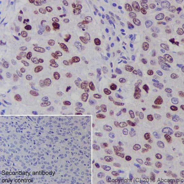 Immunohistochemistry (Formalin/PFA-fixed paraffin-embedded sections) - Anti-BRCA1 antibody [EPR19433] - BSA and Azide free (AB215988)