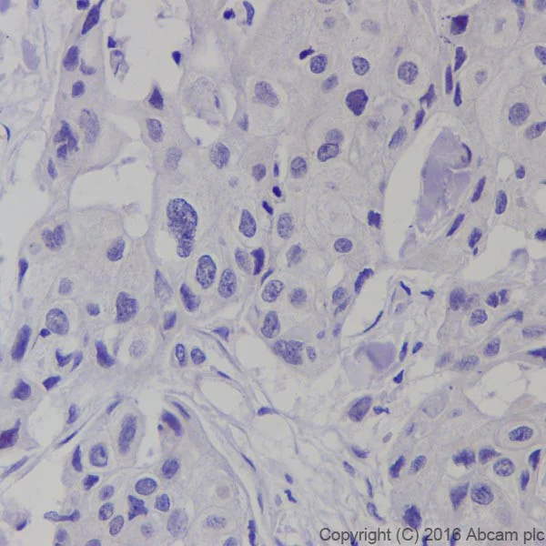 Immunohistochemistry (Formalin/PFA-fixed paraffin-embedded sections) - Anti-BRCA1 antibody [EPR19433] - BSA and Azide free (AB215988)