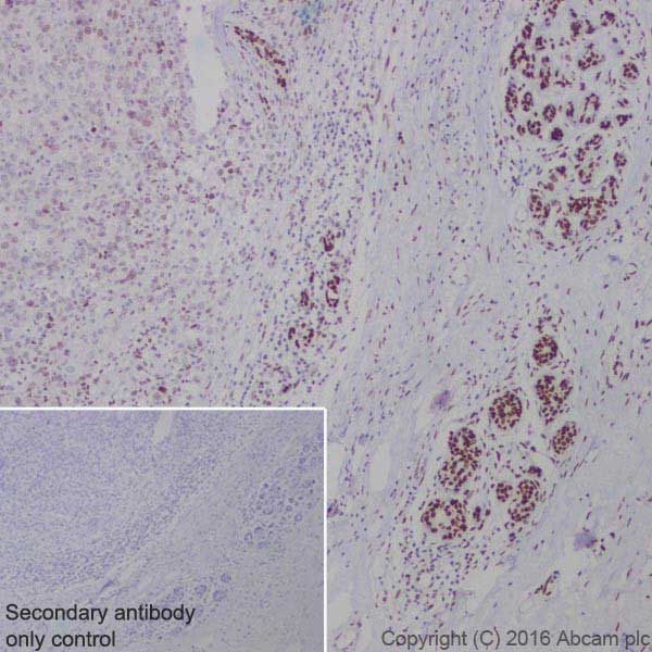 Immunohistochemistry (Formalin/PFA-fixed paraffin-embedded sections) - Anti-BRCA1 antibody [EPR19433] - BSA and Azide free (AB215988)