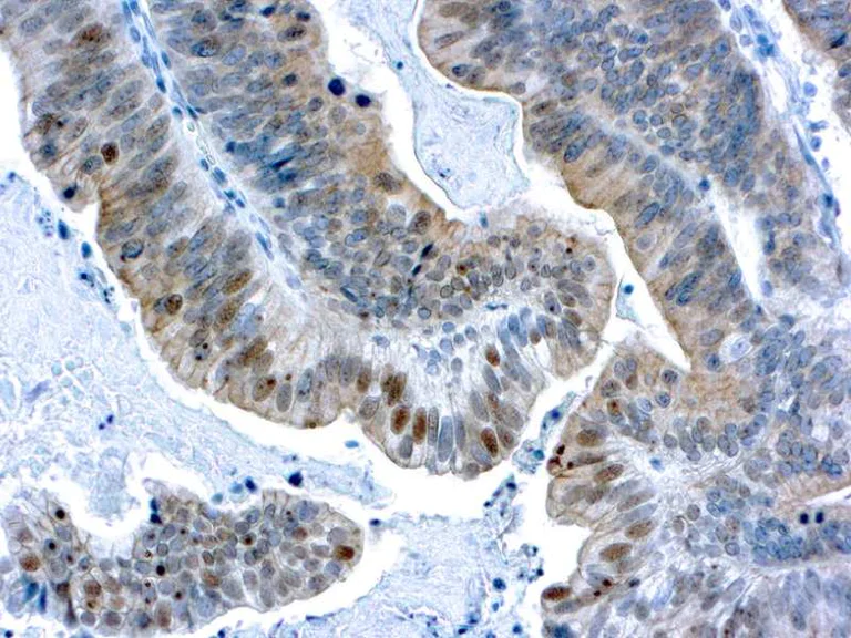 Immunohistochemistry (Formalin/PFA-fixed paraffin-embedded sections) - Anti-BRCA1 antibody [GLK-2] (AB17251)