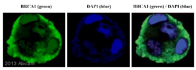 Immunocytochemistry/ Immunofluorescence - Anti-BRCA1 antibody [MS110] (ab16780), expandable thumbnail