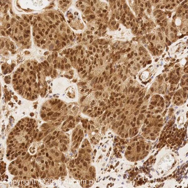 Immunohistochemistry (Formalin/PFA-fixed paraffin-embedded sections) - Anti-BRCA1 antibody [MS110] (AB16780), expandable thumbnail