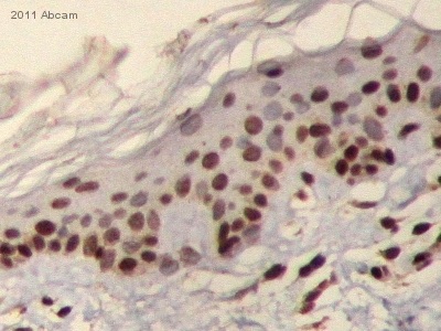 Immunohistochemistry (Formalin/PFA-fixed paraffin-embedded sections) - Anti-BRCA1 antibody [MS110] (AB16780), expandable thumbnail