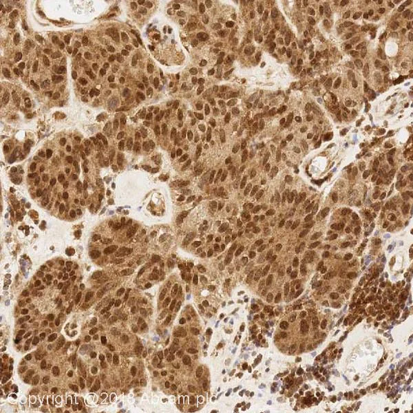 Immunohistochemistry (Formalin/PFA-fixed paraffin-embedded sections) - Anti-BRCA1 antibody [MS110] - BSA and Azide free (AB264518)