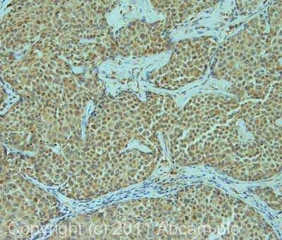 Immunohistochemistry (Formalin/PFA-fixed paraffin-embedded sections) - Anti-BRCA1 antibody [MS110] - BSA and Azide free (AB264518)