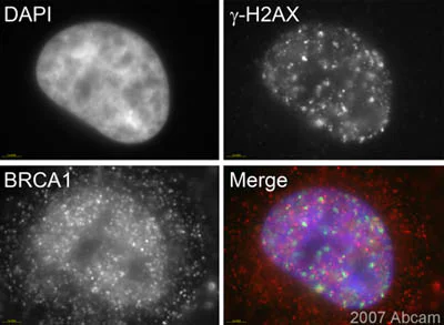 Immunocytochemistry/ Immunofluorescence - Anti-BRCA1 antibody [MS13] (AB16781)