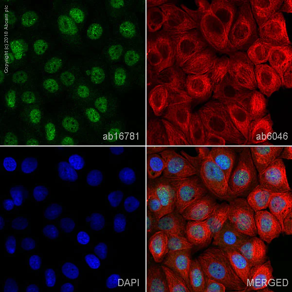 Immunocytochemistry/ Immunofluorescence - Anti-BRCA1 antibody [MS13] (AB16781)