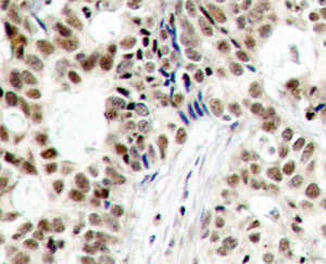 Immunohistochemistry (Formalin/PFA-fixed paraffin-embedded sections) - Anti-BRCA1 (phospho S1423) antibody (AB194753), expandable thumbnail