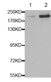 Western blot - Anti-BRCA1 (phospho S1423) antibody (AB194753), expandable thumbnail