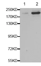 Western blot - Anti-BRCA1 (phospho S1423) antibody (AB194753)