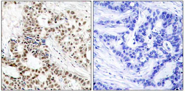 Immunohistochemistry (Formalin/PFA-fixed paraffin-embedded sections) - Anti-BRCA1 (phospho S1423) antibody (AB47325)