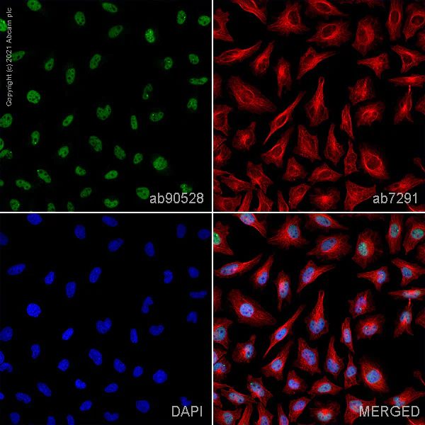Immunocytochemistry/ Immunofluorescence - Anti-BRCA1 (phospho S1423) antibody (AB90528)