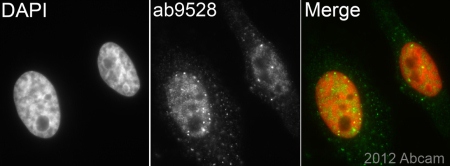 Immunocytochemistry/ Immunofluorescence - Anti-BRCA1 (phospho S1423) antibody (AB90528)