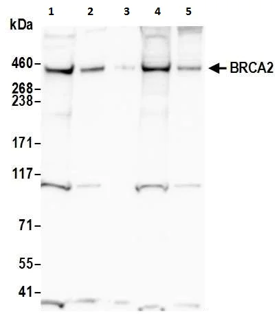 Western blot - Anti-BRCA2 antibody (AB123491)