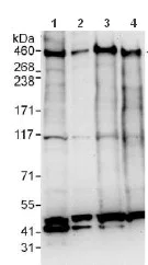 Western blot - Anti-BRCA2 antibody (AB123491)