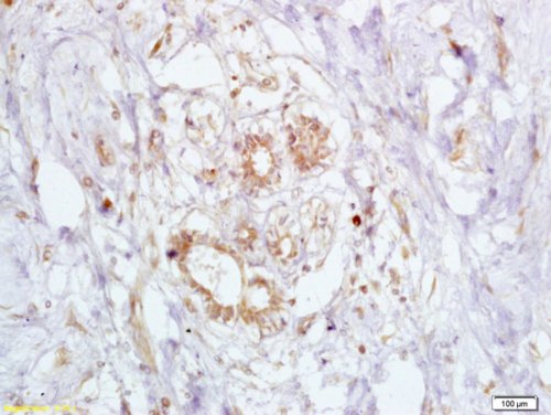 Immunohistochemistry (Formalin/PFA-fixed paraffin-embedded sections) - Anti-BRCA2 antibody (AB216972)