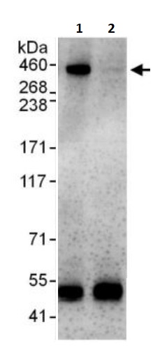 Immunoprecipitation - Anti-BRCA2 antibody (AB245377)