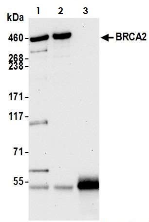 Immunoprecipitation - Anti-BRCA2 antibody (AB9143), expandable thumbnail