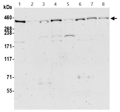 Western blot - Anti-BRCA2 antibody (AB9143), expandable thumbnail