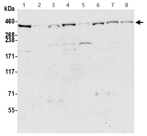 Western blot - Anti-BRCA2 antibody (AB9143)